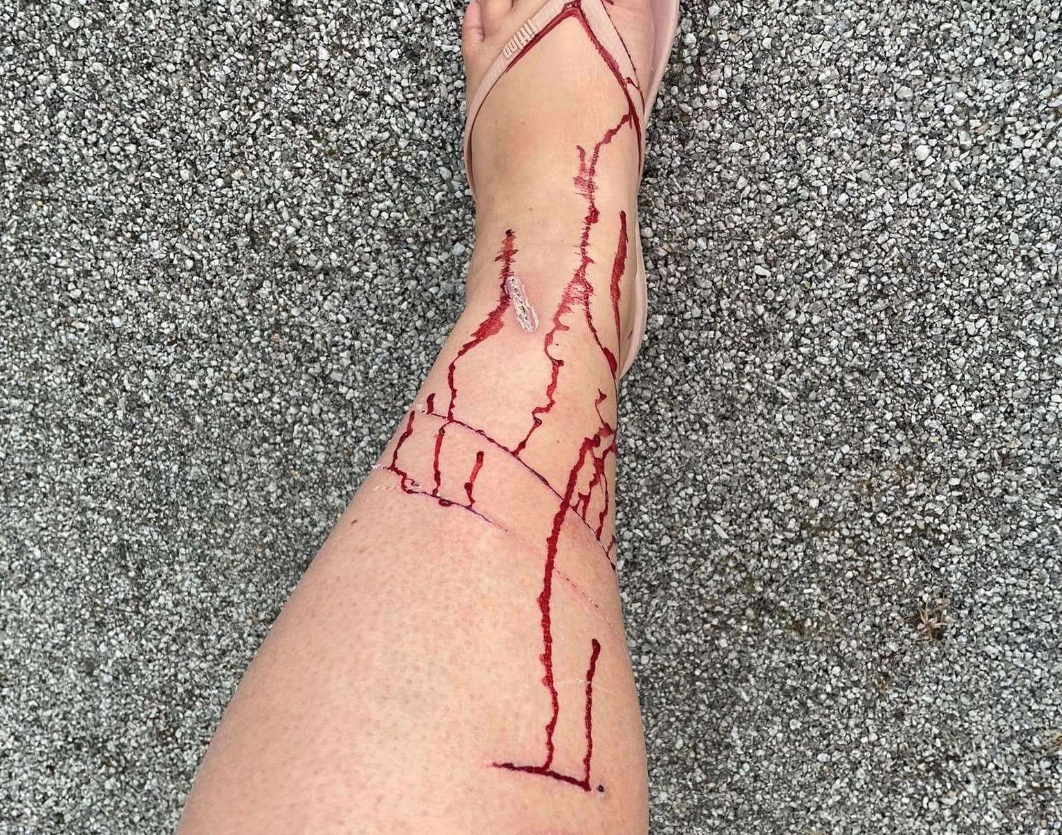 A woman was scratched by a cat on the leg while walking her dogs