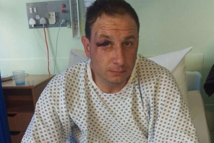 Lee Terry in hospital after the incident outside the Jolly Knight