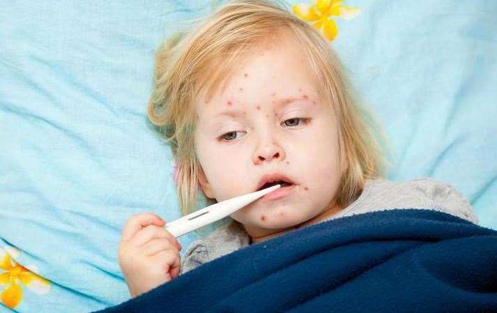 London is at risk of a measles outbreak says the government. Image: iStock.