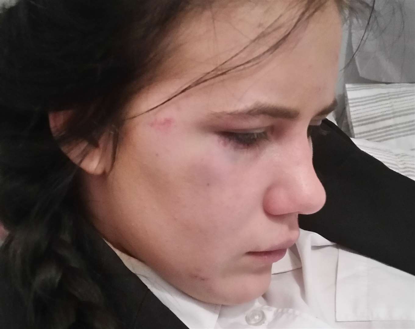 Madison Coggin needed hospital treatment after being set upon my bullies (10428151)