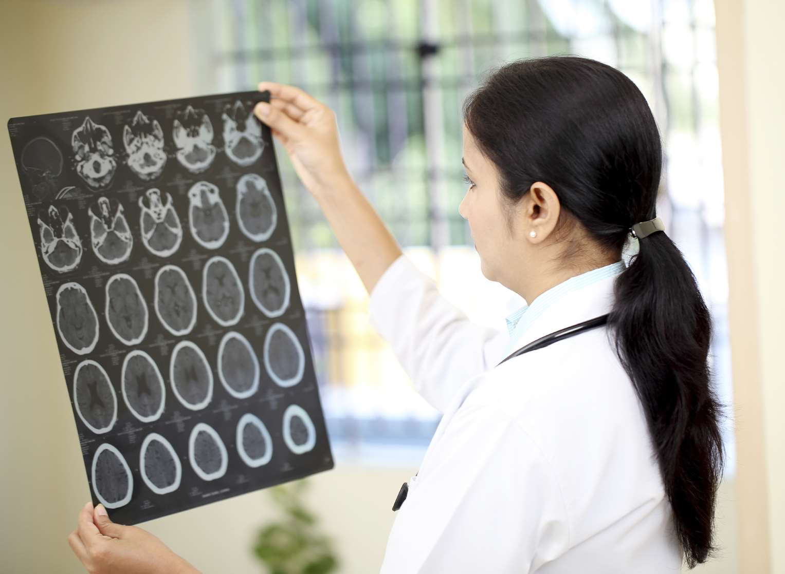 Doctor checks for signs of a brain tumour. iStock image/