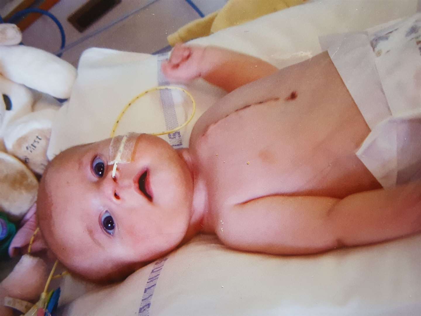 Caitlin Goodsell had to have multiple heart operations from the age of four months. Picture: Demelza Hospice