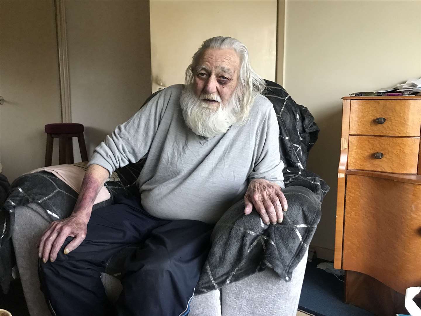 Arthur Chew from Minster, Sheppey, after he was attacked and robbed in his own home in October 2020. Picture: Chloe Holmwood