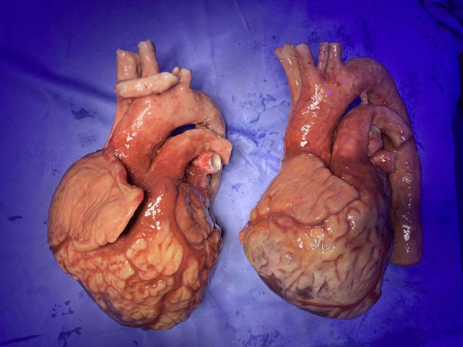 A model diseased heart (left) and a model healthy one (Nottingham Trent University/PA)