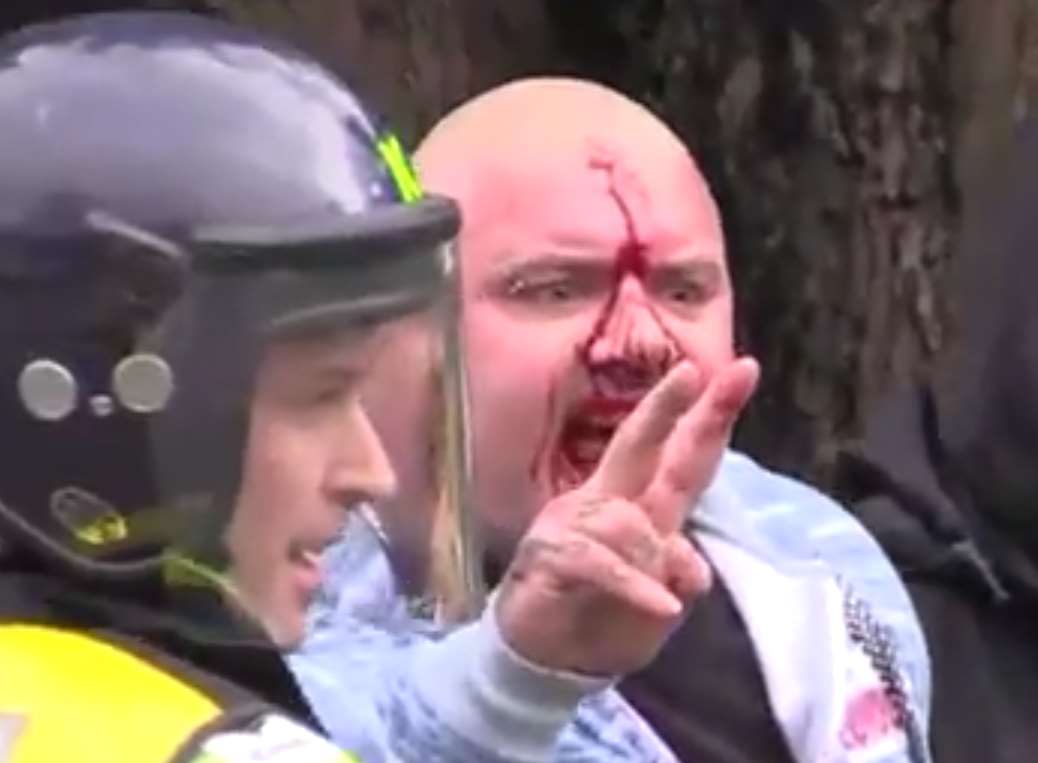 Blood pours down the face of injured man during the January clash