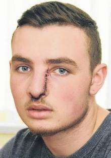 Charlie Carolan was millimetres from death after a knife attack