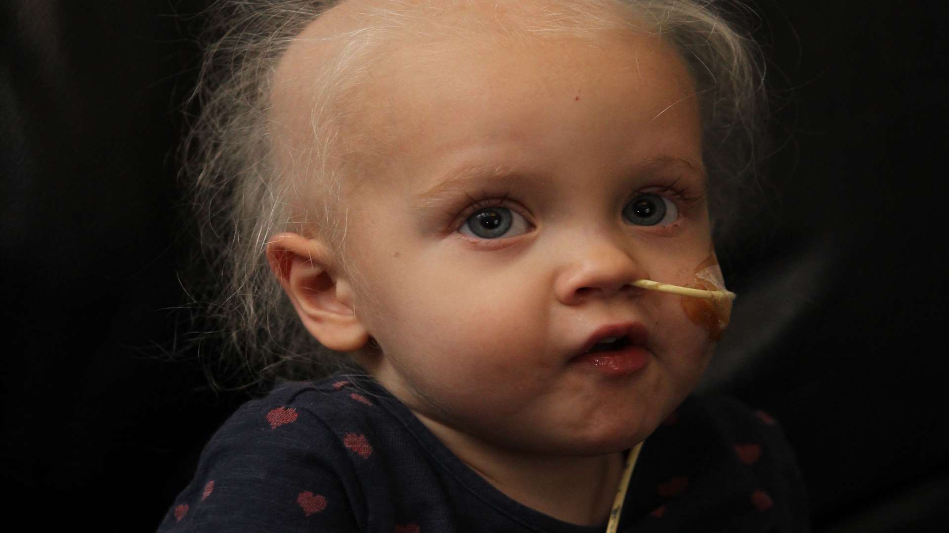 Ruby Young, two, from Rainham has Neuroblastoma