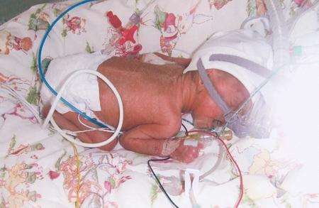 Mikey aged four weeks in an incubator at the Oliver Fisher unit at Medway Hospital.