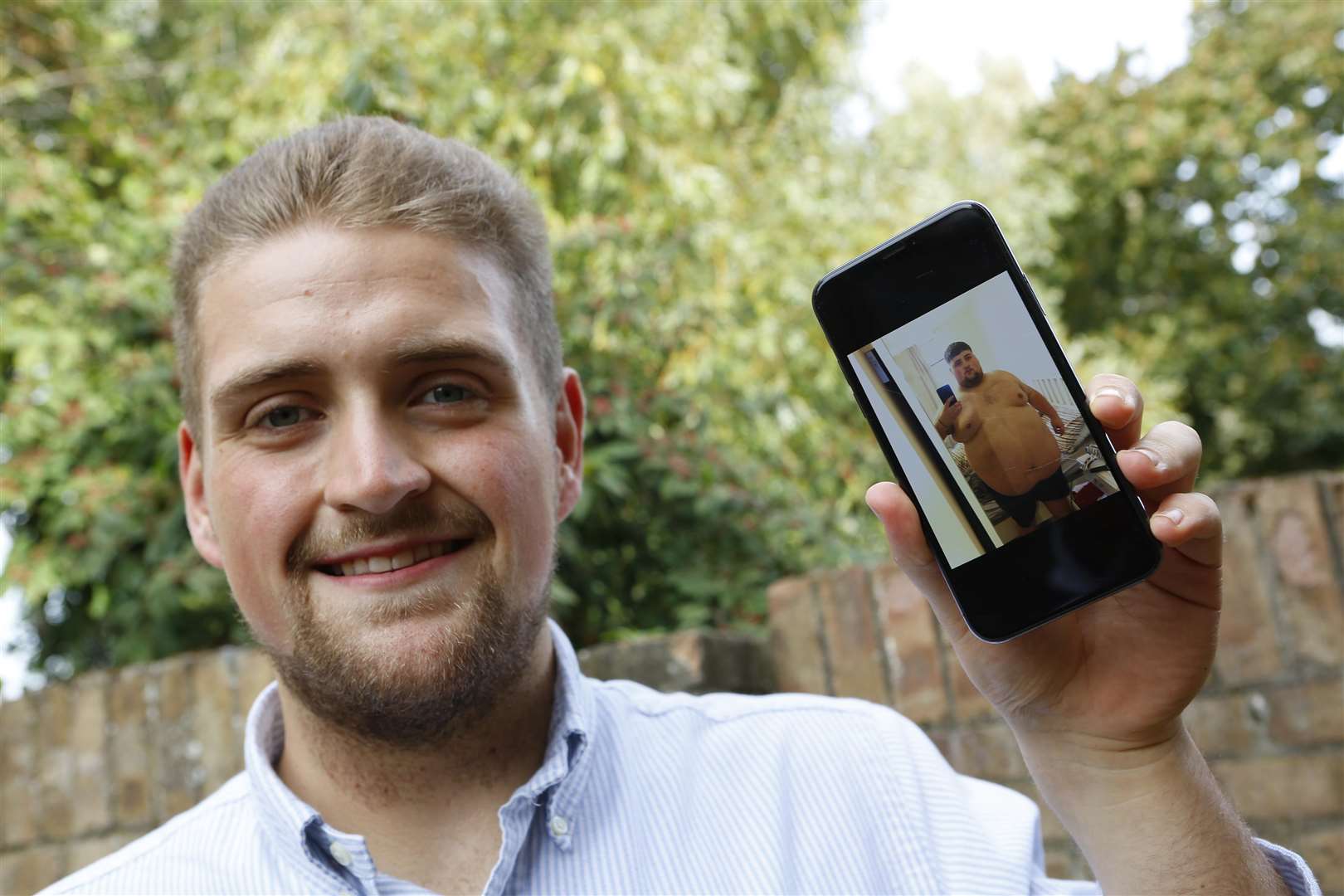 Jack Towers lost 18 stone and is raising money for loose skin surgery. Picture: Andy Jones