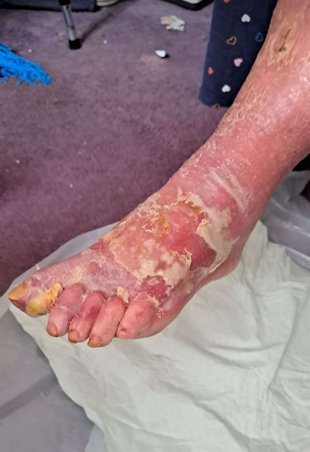 Granddaughter Kimberley Bracey took additional photos of her nan's foot after suspecting something was wrong. Photo: Family release