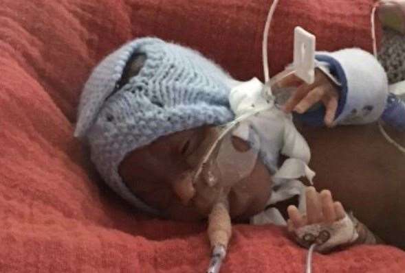 Elijah Johnson was born 16 weeks premature and is being cared for at the Royal Sussex County Hospital in Brighton (41579738)