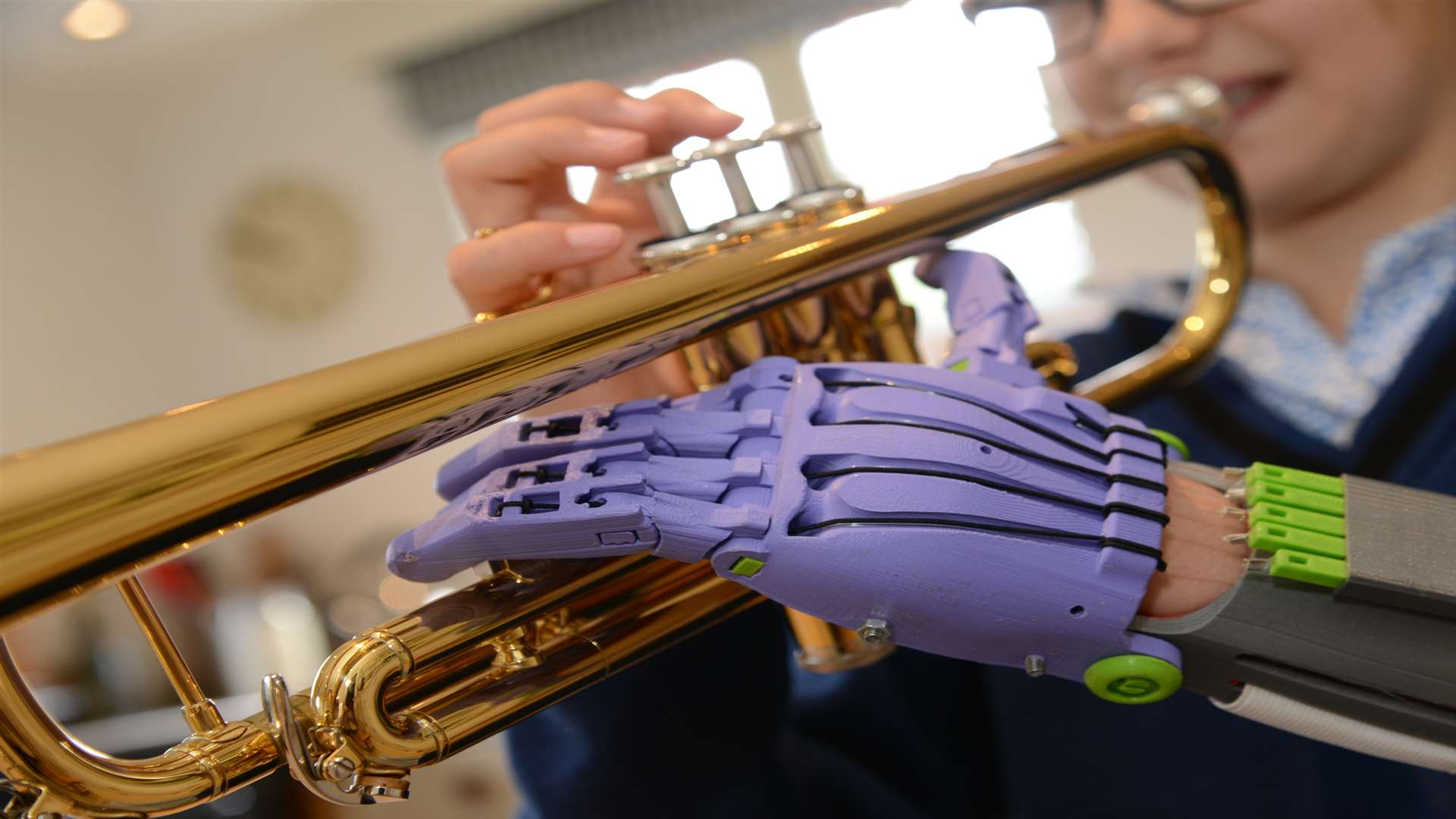 Lara can play the trumpet, piano and other instruments with her new hand. Picture: Gary Browne