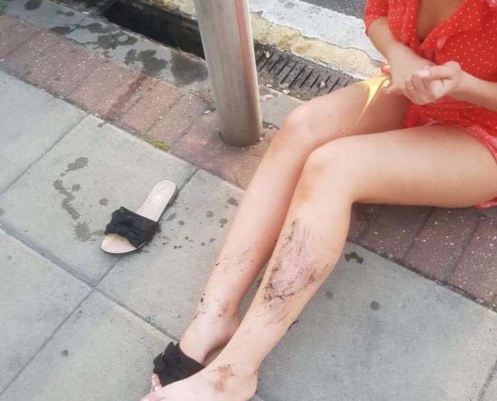Aleksandra's new flip flops were ruined after she fell through a drain in KFC at Strood Retail Park (13351546)