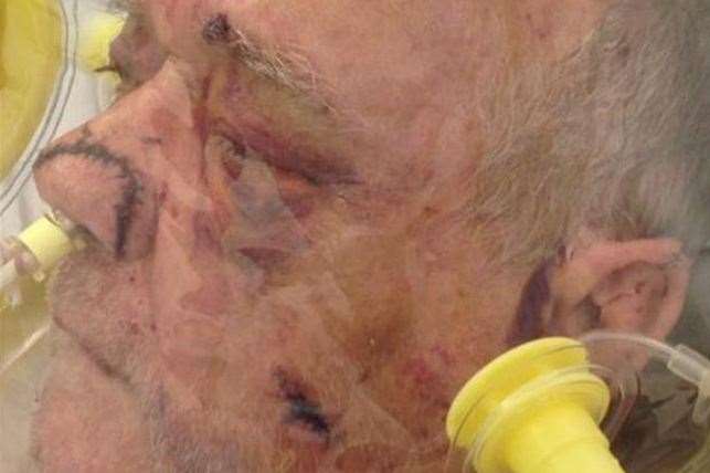 Ex-Merchant Navy sailor Kenneth Seymour was battered at his home in Rutland Avenue in Margate – and suffered fractures of the nose, head and back.