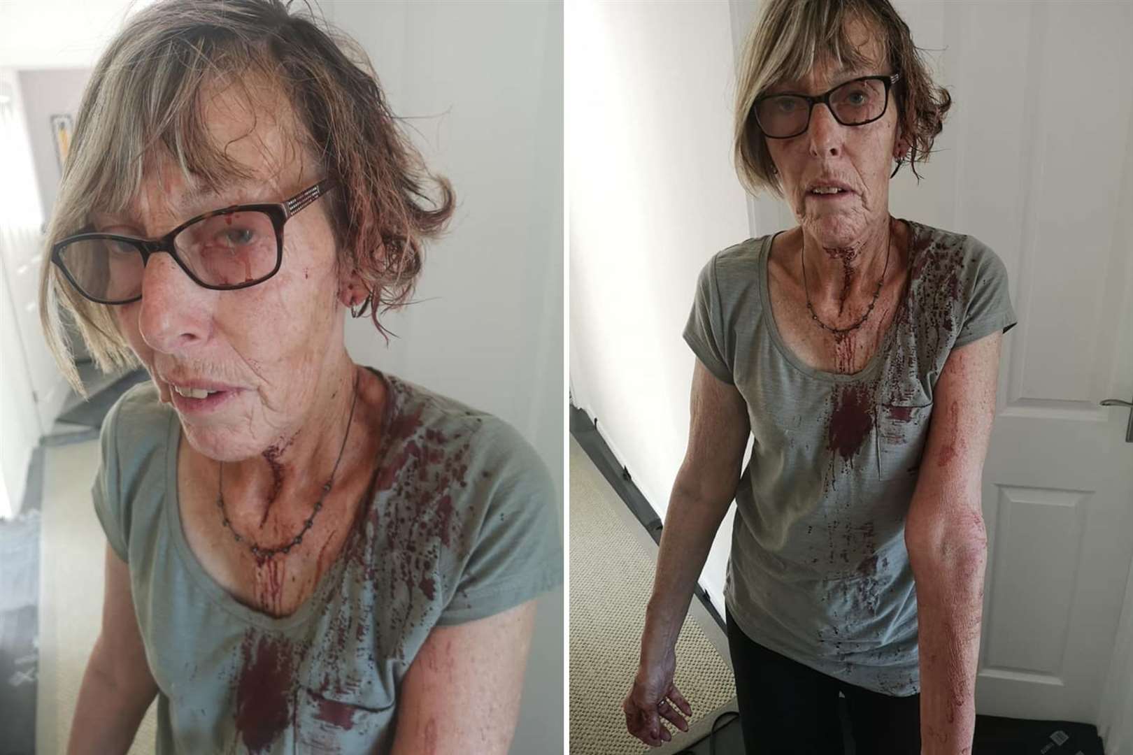 Brenda Thrumble was left soaked in blood after being attacked by a vicious seagull in St Peters