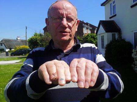 Postman Phil Clilverd had part of his finger ripped off by a dog.