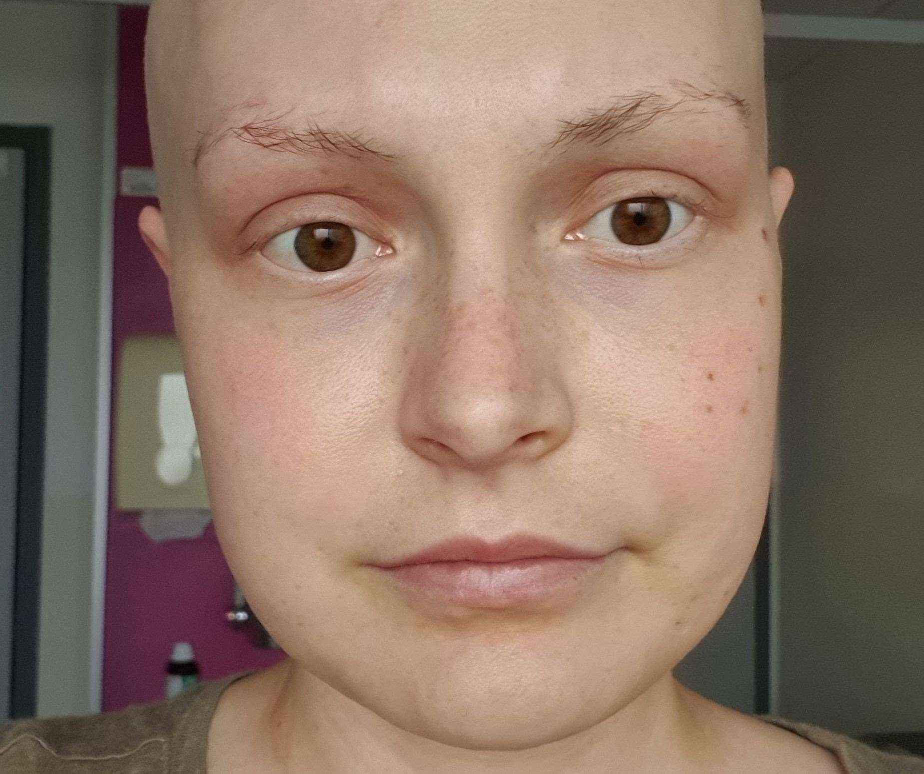 The 24-year-old is warning others about her symptoms. Picture: SWNS