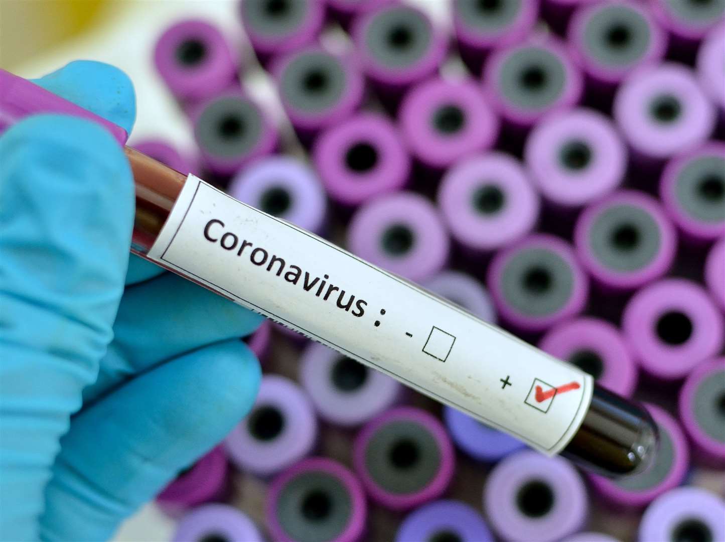 As of yesterday, seven people in Kent have tested positive for coronavirus