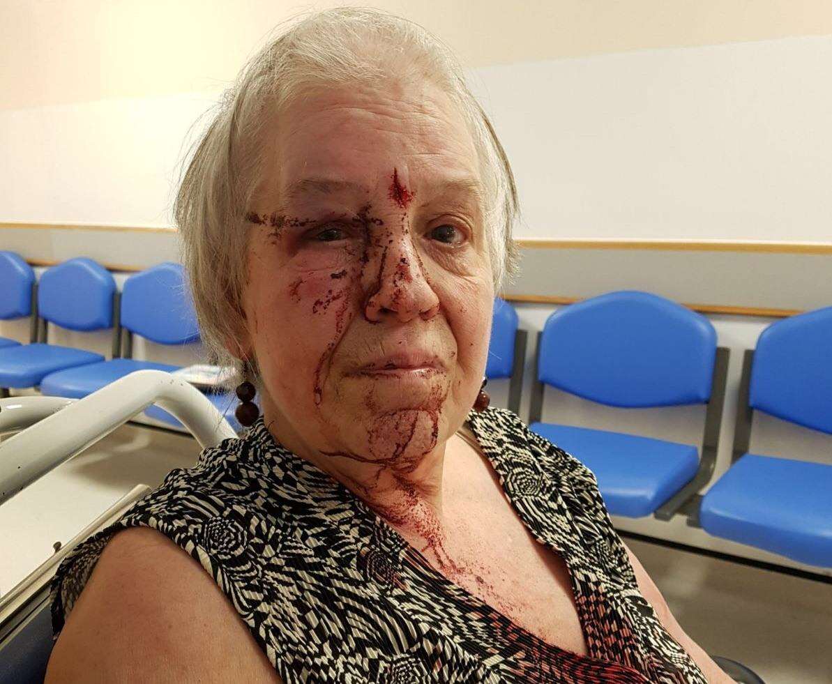 Lesley Wilson, 69, was punched and kicked when she had her handbag stolen (1941896)