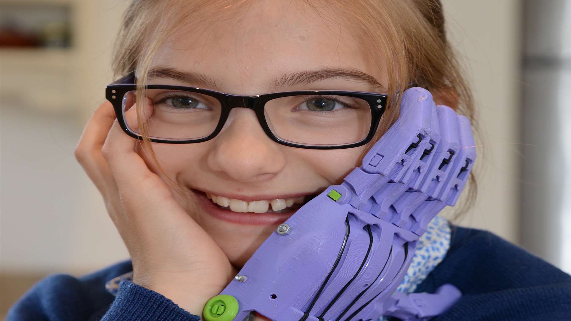 Lara Pincott with her 3D designed prosthetic hand Picture: Gary Browne