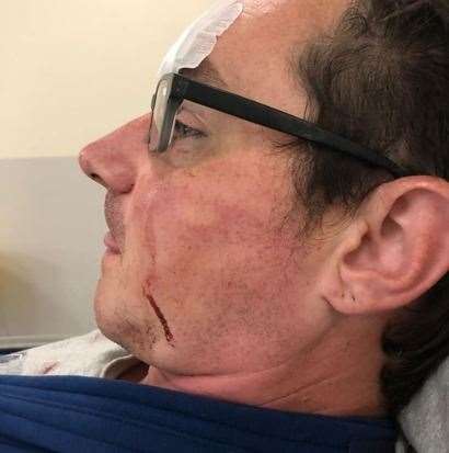 Lee Jackson was set upon by a gang in the Great Lines in Gillingham leaving him with severe injuries, multiple fractures and a bleed on the brain