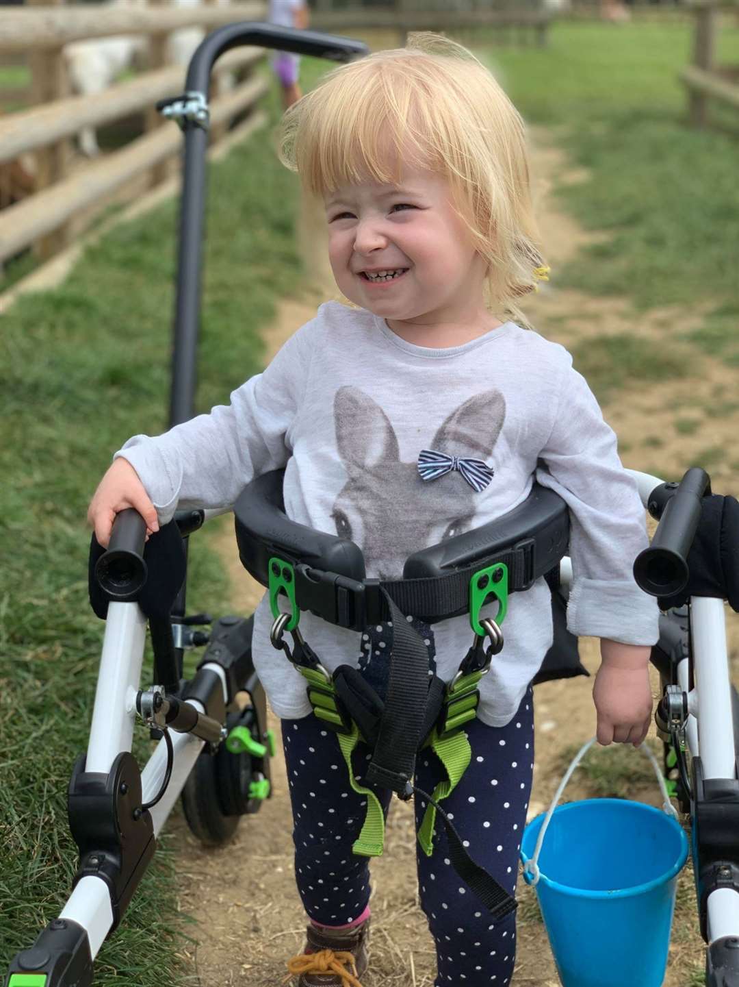 Willow, 2, suffers from spina bifida and requires a walking frame to assist her