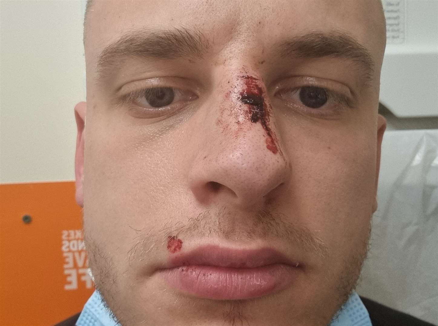 Sean Crittenden was attacked outside Tesco Express at Victory Pier in Gillingham