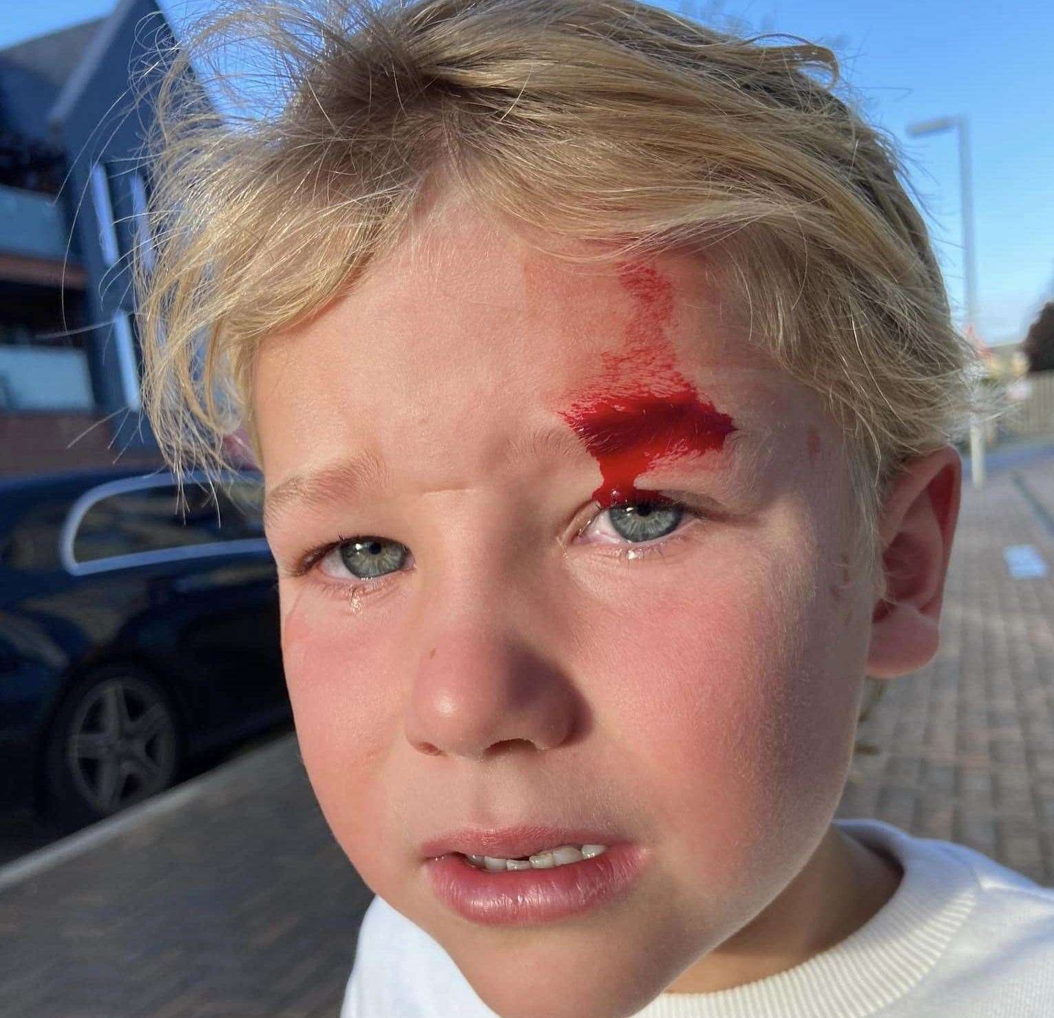 Miss Howes' five-year-old son Georgie was left in tears after running into an exposed screw in a fence in Repton Park in Ashford. Picture: Sophie Howes