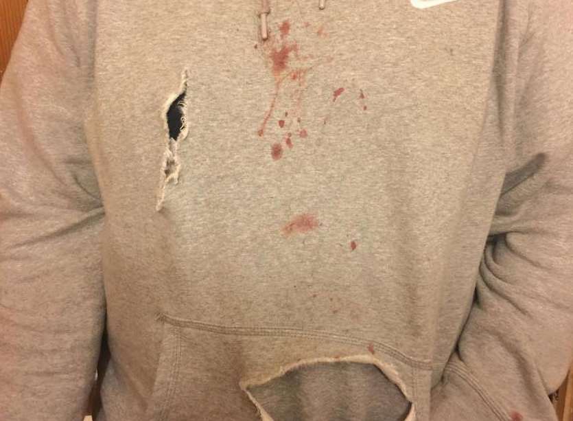 Macauley pictured after the alleged attack in his blood-stained grey hoodie