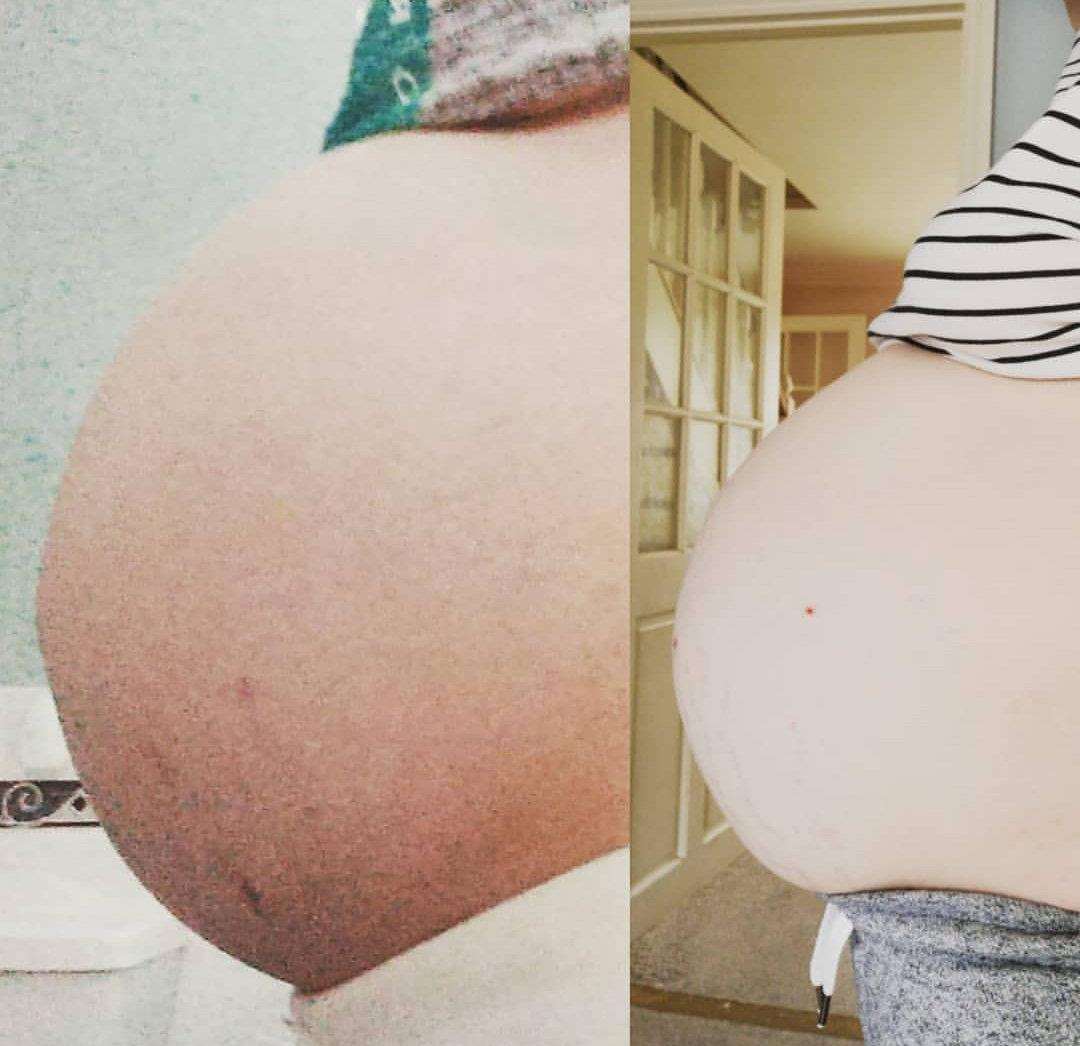 Jessica Phoenix at 32 weeks pregnant with her first twins, left, and second set of twins. Picture: SWNS
