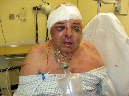 This pensioner was attacked in his home.