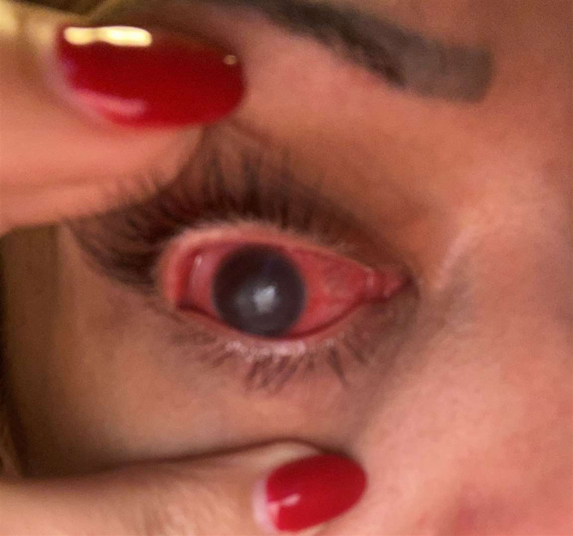 Shereen-Fay Griffin says she woke up blind in one eye. Photo credit: SWNS