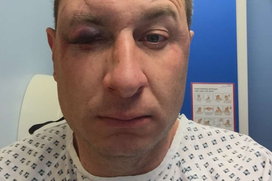 Lee Terry suffered various injuries including a black eye