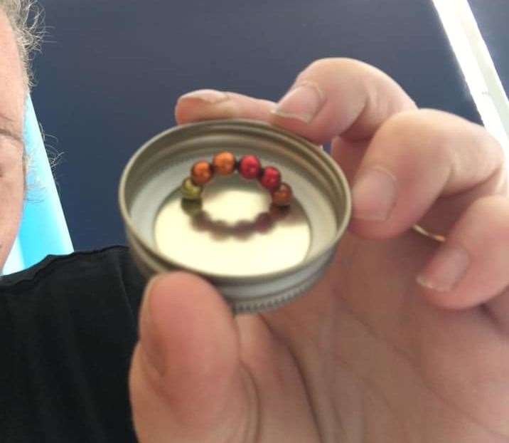 The small magnets that were removed from Mickey's colon. Picture: Elaine Hambly