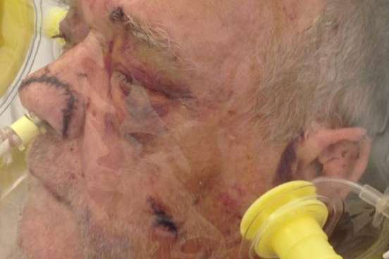 Pensioner Ken Seymour pictured in hospital with horrific injuries
