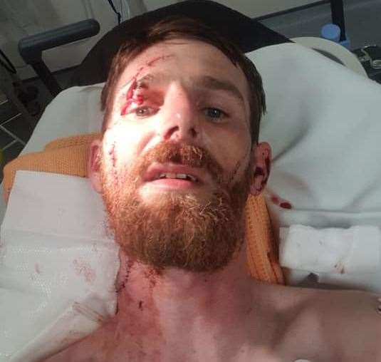 Daniel in hospital after the attack in August last year