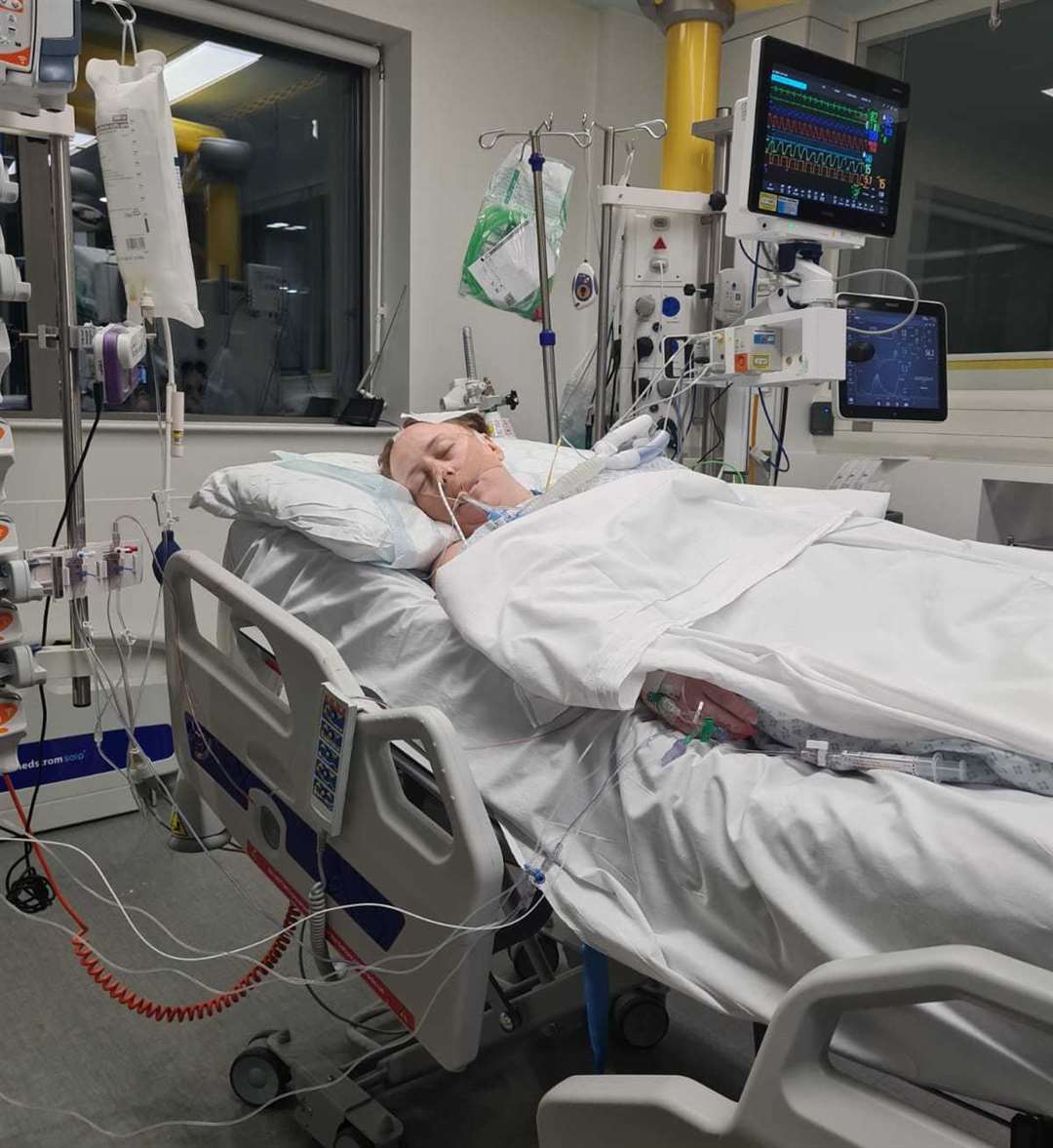 Amie Hodgson in the critical care unit at Kings College Hospital. Photo credit: Danny Hodgson