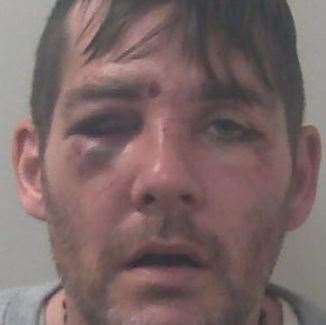 Anthony Kingwell's mugshot shows the extent of the injuries he incurred during his attempted getaway