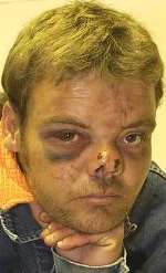 BRUISED: John Sayers was so badly beaten he could not attend the opening of Lily Smith House. Picture: JOHN WARDLEY