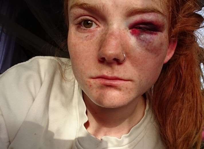 Millie Godfrey thought she was going to die in the brutal attack