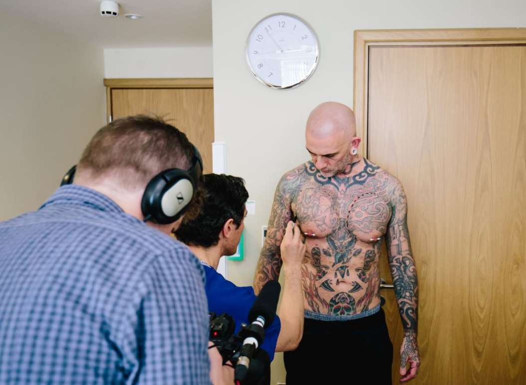 Mr Ibbittson had pectoral implants which he later had removed. Picture: Parkershots Ltd