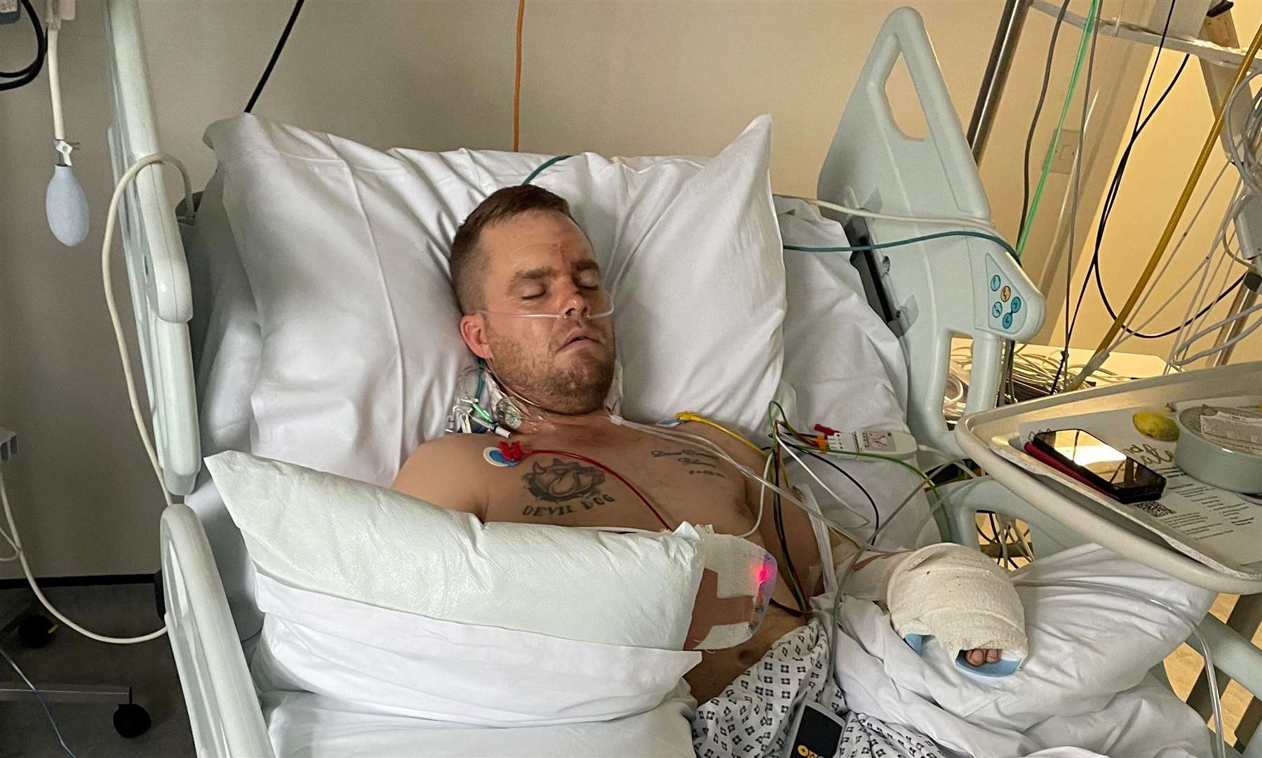 Steven Gilmore in hospital after the incident. Picture: Vicky Blackman
