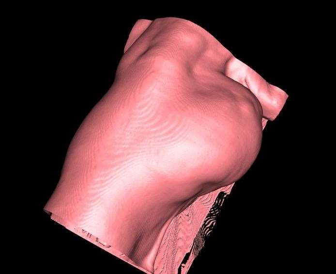 A 3D image of a scan showing Purdey's tumour. Picture: North Downs Specialist Referrals