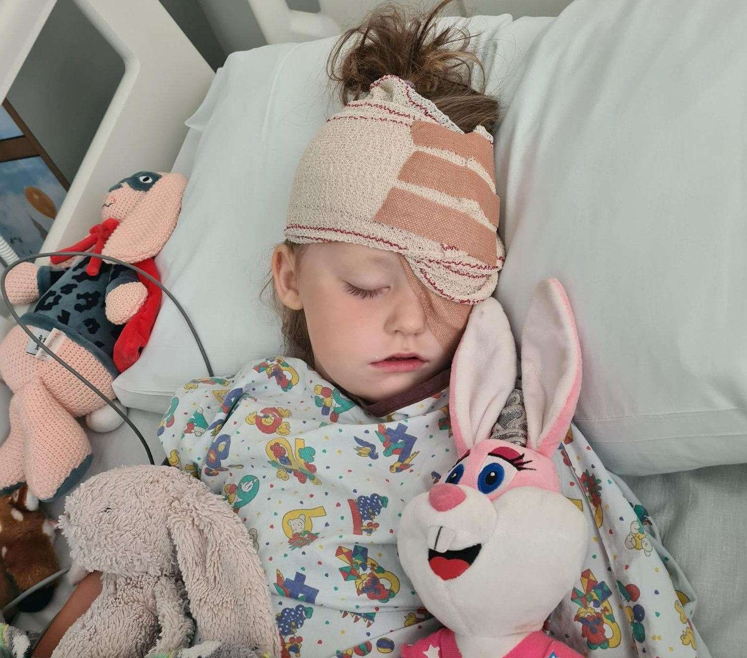 Darcey-Rose Hickson after having her eye removed. Picture: SWNS
