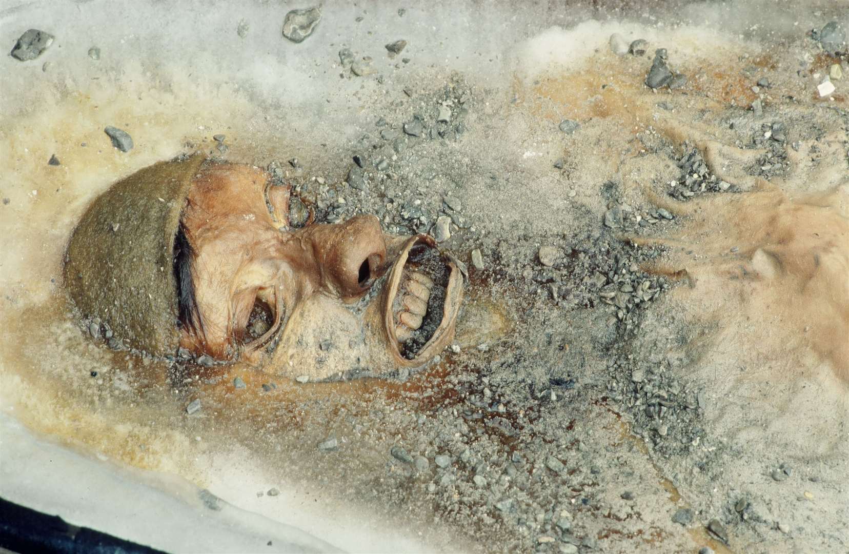Pefectly preserved in the ice, John's face still has recognisable features. Picture: Brian Spenceley