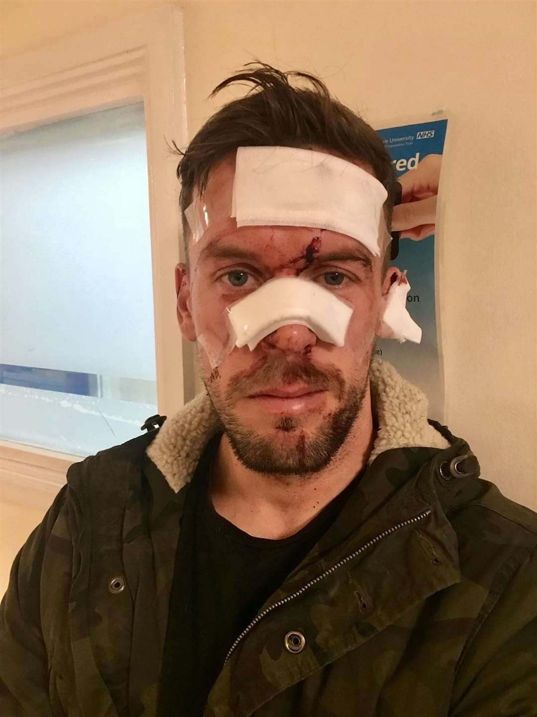 Scott Richards following the attack. Picture: SWNS