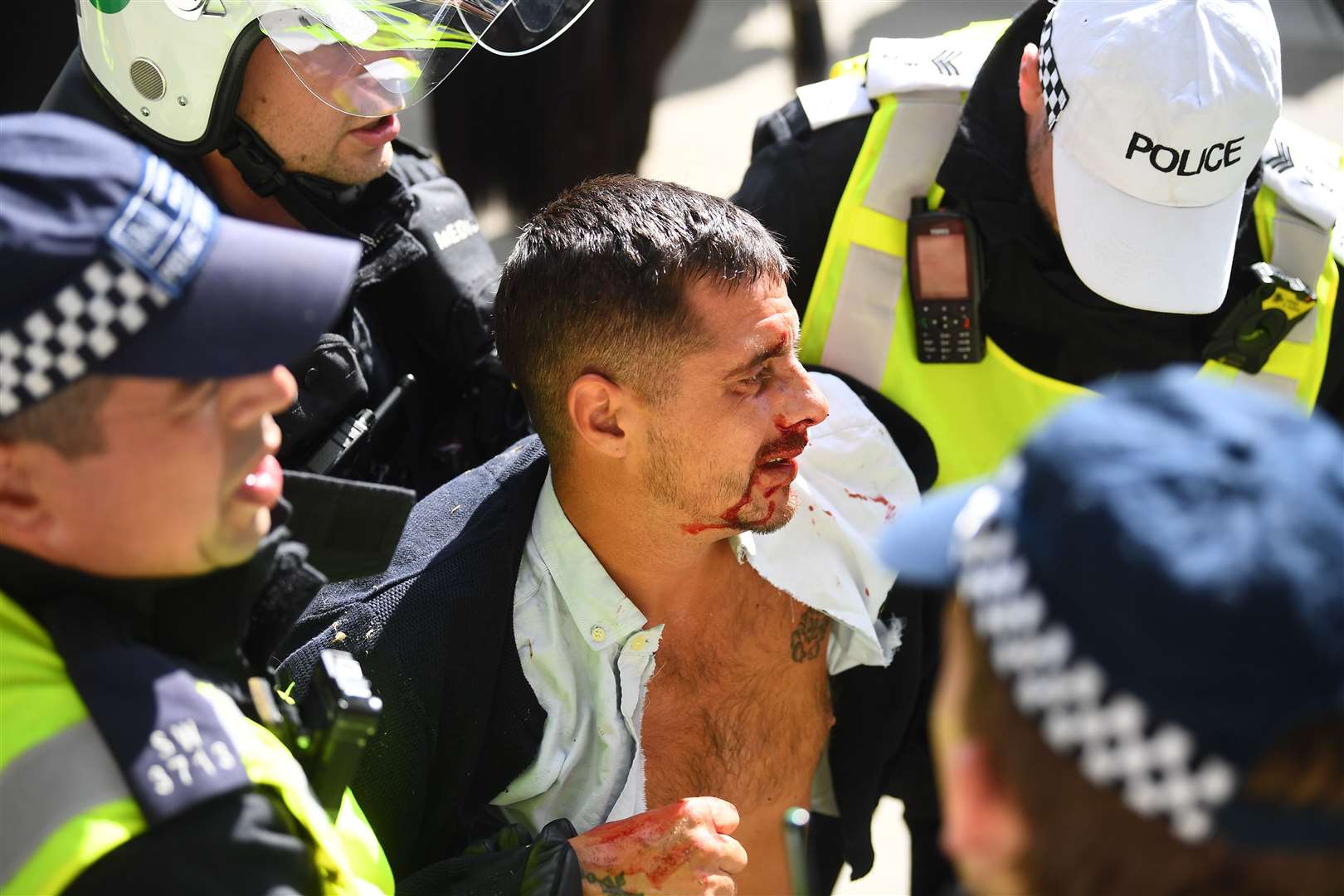 A demonstrator with a facial injury in Trafalgar Square, London (Victoria Jones/PA)