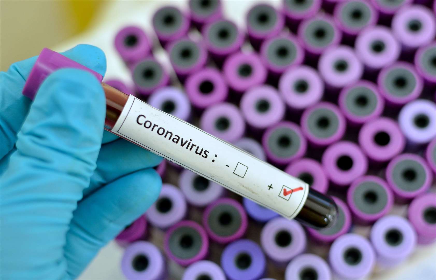 The coronavirus has hit Singapore where 90 cases have been confirmed