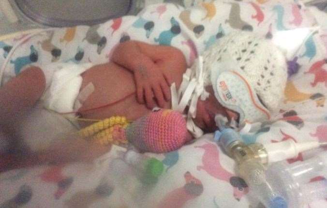 Baby Bonnie spent the first week of her life on a ventilator