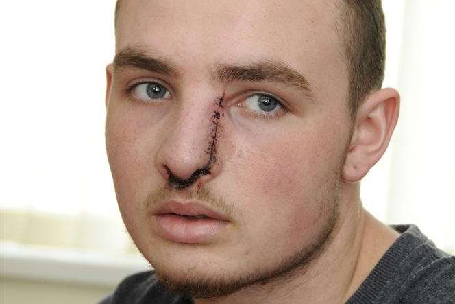 Charlie Carolan was badly injured in a knife attack